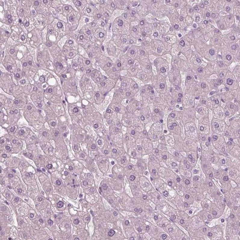 Staining of human liver shows no nuclear positivity in hepatocytes as expected.