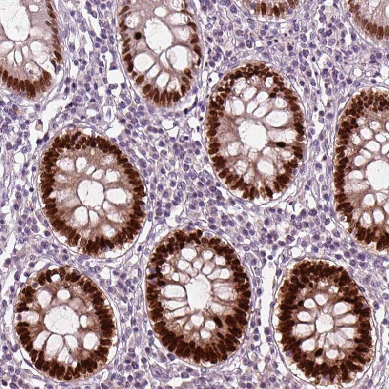 Staining of human colon shows moderate to strong nuclear positivity in glandular cells.