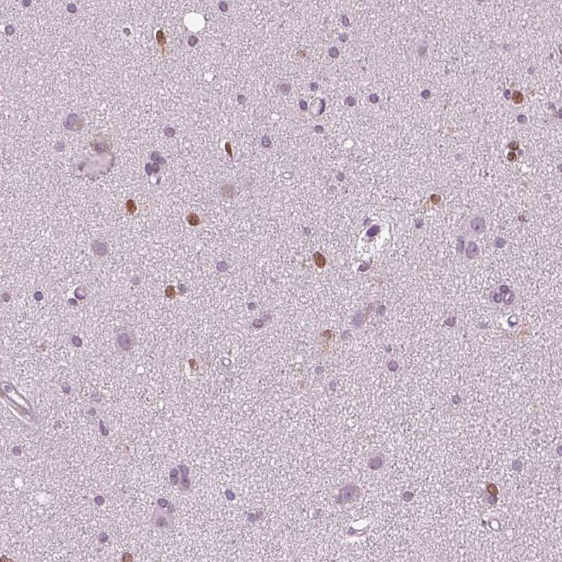 Staining of human cerebral cortex shows moderate to strong nuclear positivity in a subset of glial cells.
