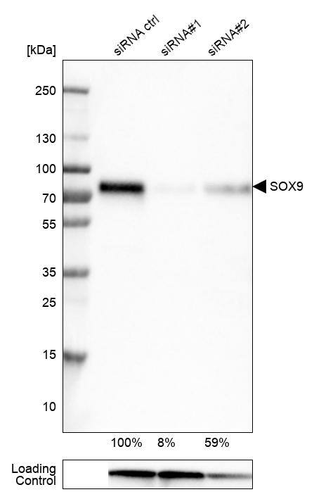 Analysis in U-251MG cells transfected with control siRNA, target specific siRNA probe #1 and #2, using Anti-SOX9 antibody. Remaining relative intensity is presented. Loading control: Anti-GAPDH.