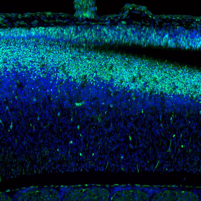 Staining of mouse embryo E11 shows moderate to strong positivity in the developing neural tube.