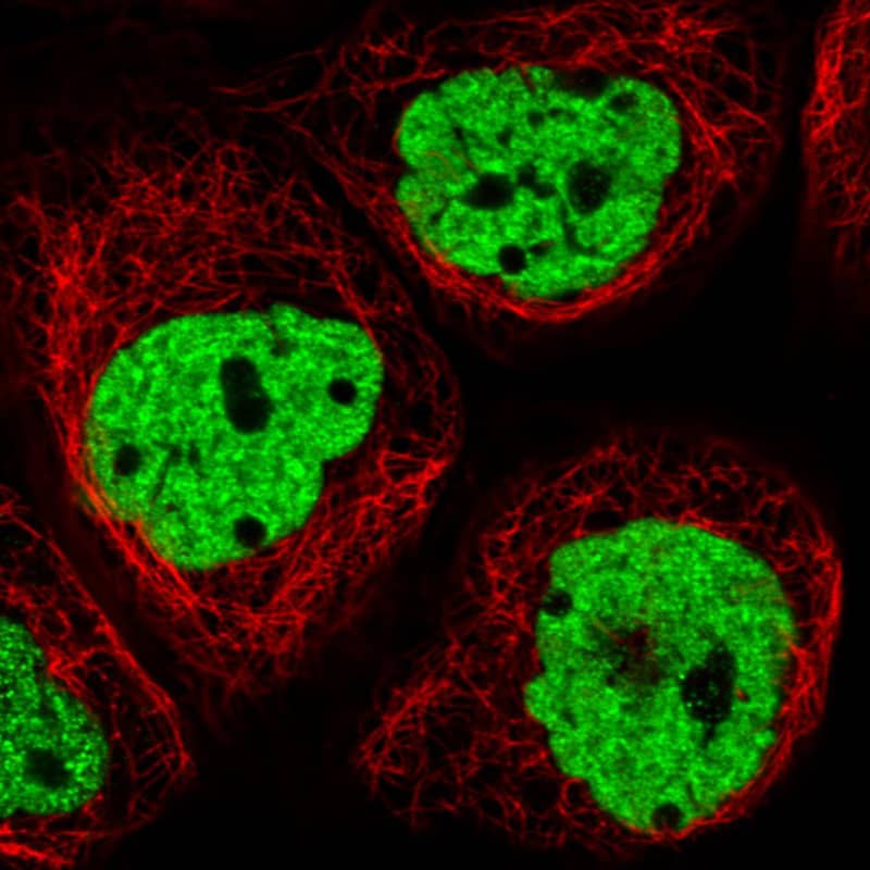 Staining in A431 cell line with Anti-hnRNP C1 + C2 monoclonal antibody) staining in green. Microtubule- and nuclear probes are visualized in red and blue respectively (where available).