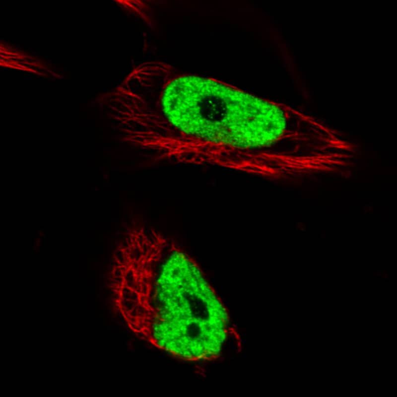 Staining in U251 cell line with Anti-hnRNP C1 + C2 monoclonal antibody) staining in green. Microtubule- and nuclear probes are visualized in red and blue respectively (where available).