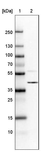 Lane 1: Marker [kDa]Lane 2:Human cell line U-251 MG