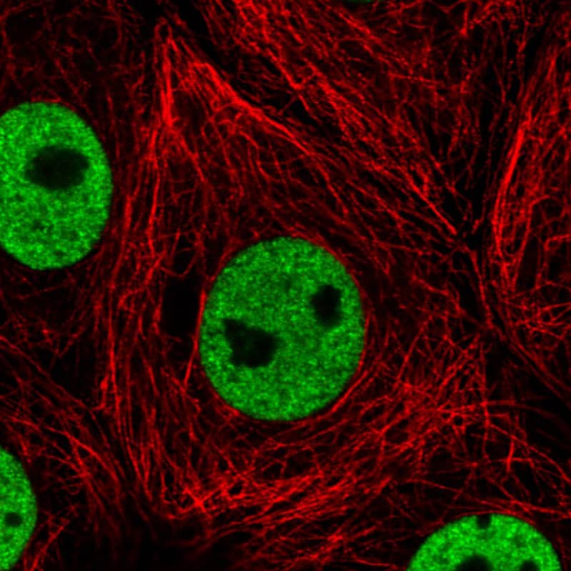 Staining in MCF7 cell line with Anti-hnRNP C1 + C2 monoclonal antibody) staining in green. Microtubule- and nuclear probes are visualized in red and blue respectively (where available).