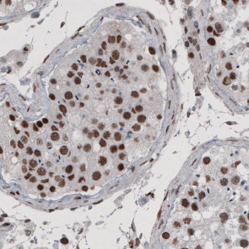 Staining of human testis shows nuclear positivity in seminiferous tubules.