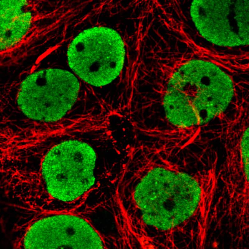 Staining in MCF7 cell line with Anti-FUS monoclonal antibody) staining in green. Microtubule- and nuclear probes are visualized in red and blue respectively (where available).