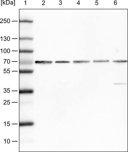 Lane 1: Marker [kDa]Lane 2: Human cell line HeLaLane 3: Human cell line A-431Lane 4: Human cell line MCF-7Lane 5: Human cell line U2-OSLane 6: Human cell line Hep-G2