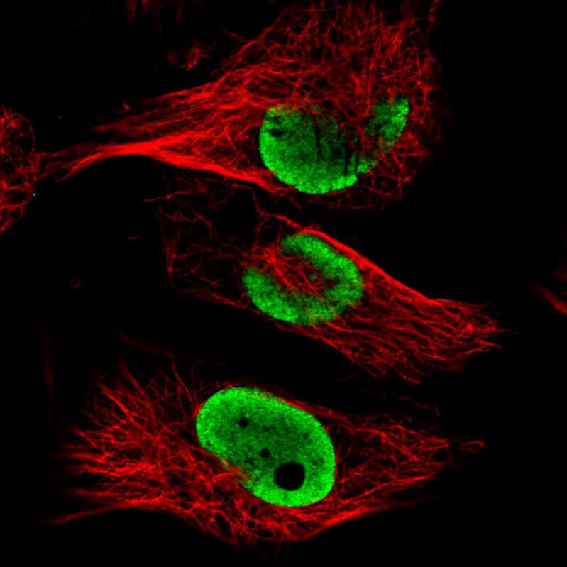 Staining in U251 cell line with Anti-FUS monoclonal antibody) staining in green. Microtubule- and nuclear probes are visualized in red and blue respectively (where available).