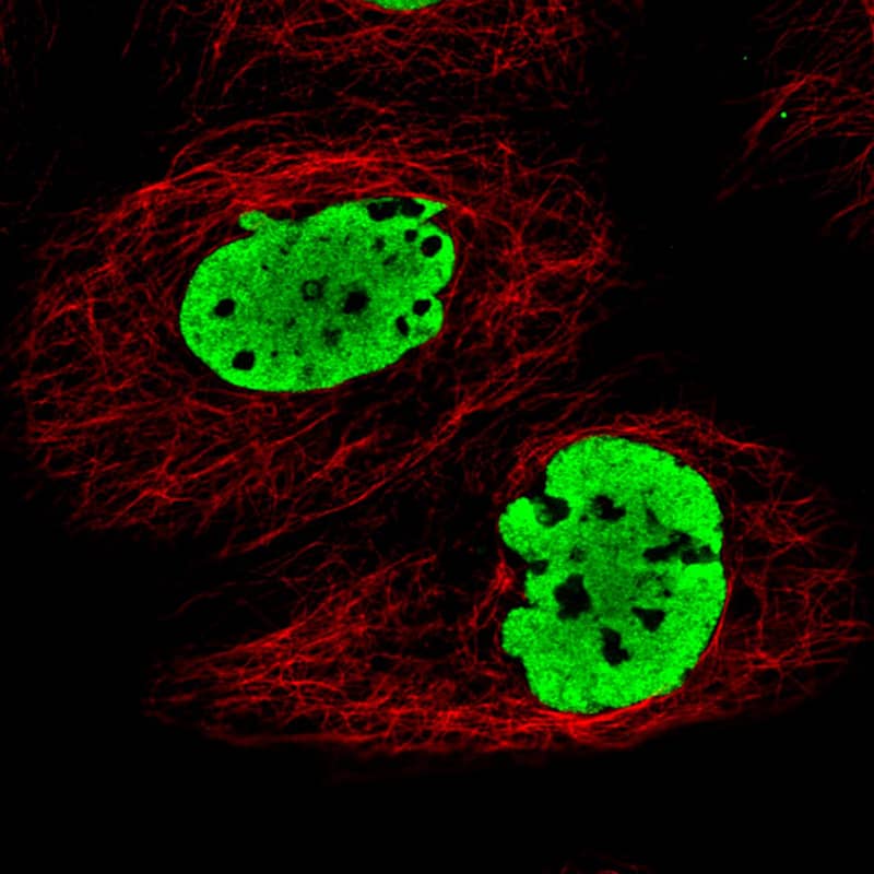 Staining in A431 cell line with Anti-FUS monoclonal antibody) staining in green. Microtubule- and nuclear probes are visualized in red and blue respectively (where available).