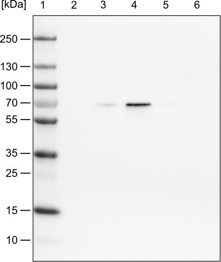 Lane 1: Marker [kDa]Lane 2: Human cell line HeLa cytoplasmic fractionLane 3: Human cell line HeLa membrane fractionLane 4: Human cell line HeLa nuclear fractionLane 5: Human cell line HeLa chromatin fractionLane 6: Human cell line HeLa cytoskeletal fraction