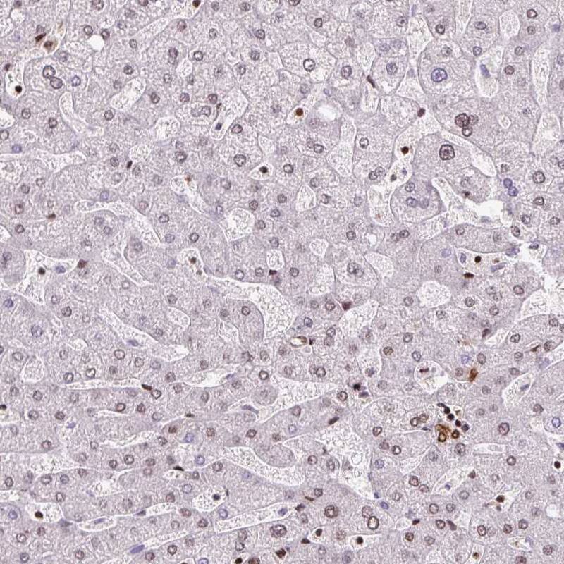 Staining of human liver shows only very weak nuclear positivity in hepatocytes.