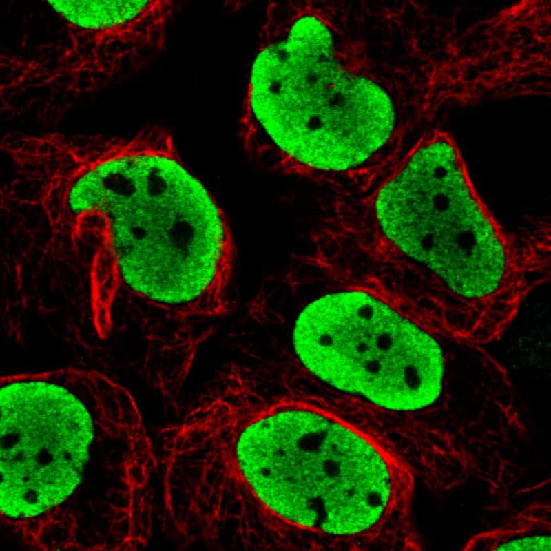 Staining in U2OS cell line with Anti-FUS monoclonal antibody) staining in green. Microtubule- and nuclear probes are visualized in red and blue respectively (where available).