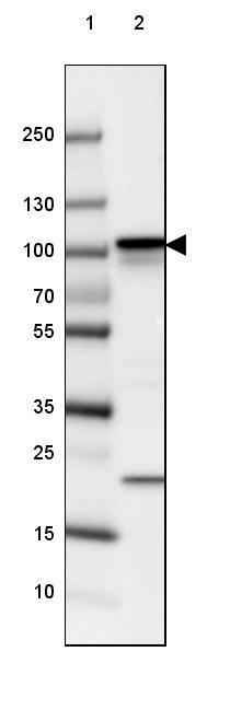 Lane 1: Marker [kDa] 250, 130, 100, 70, 55, 35, 25, 15, 10Lane 2: Human cell line SK-MEL-30