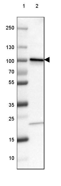 Lane 1: Marker [kDa] 250, 130, 100, 70, 55, 35, 25, 15, 10Lane 2: Human cell line A-549