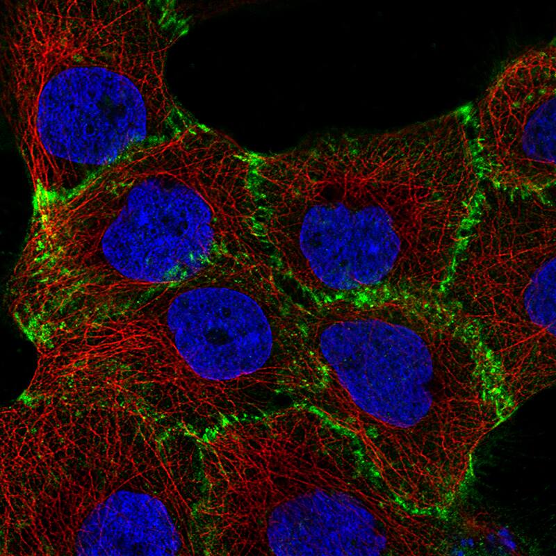 Staining of A-431 cells using the Anti-beta-Catenin monoclonal antibody) .