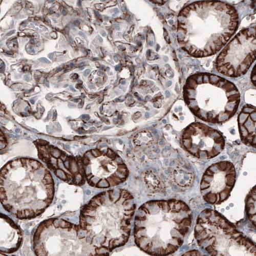 Staining of human kidney shows strong membranous positivity in renal tubules and glomerulus cells.