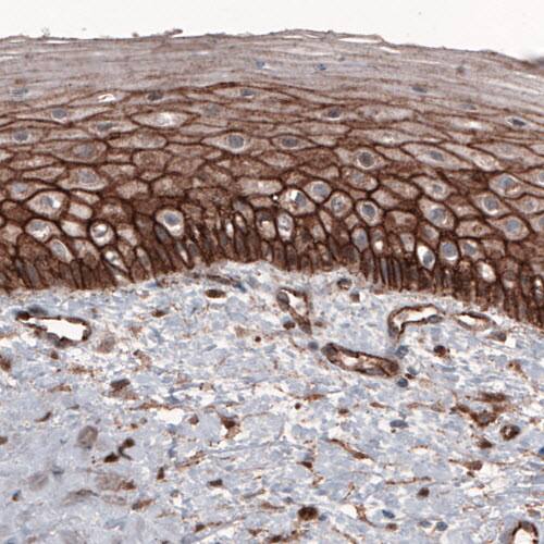 Staining of human cervix shows strong membranous positivity in epithelial cells.