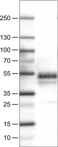 Lane 1: Marker [kDa]Lane 2: Human tonsil tissue lysate