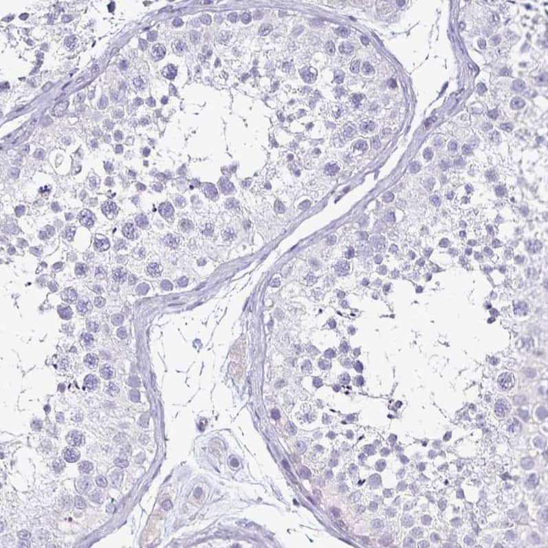 Staining of human testis shows no positivity in cells in seminiferous ducts as expected.
