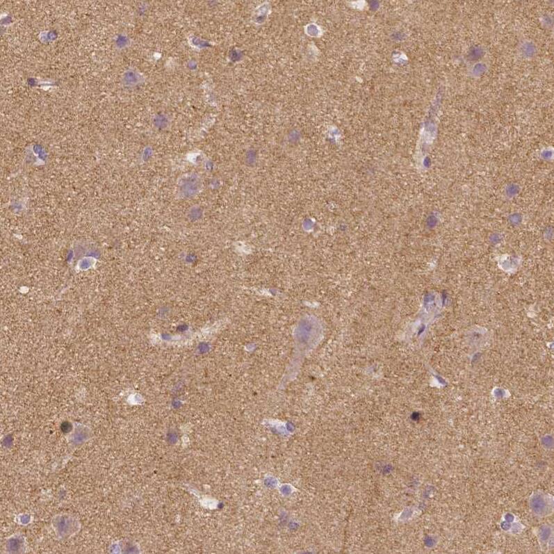 Staining of human cerebral cortex shows moderate positivity in neuropil.