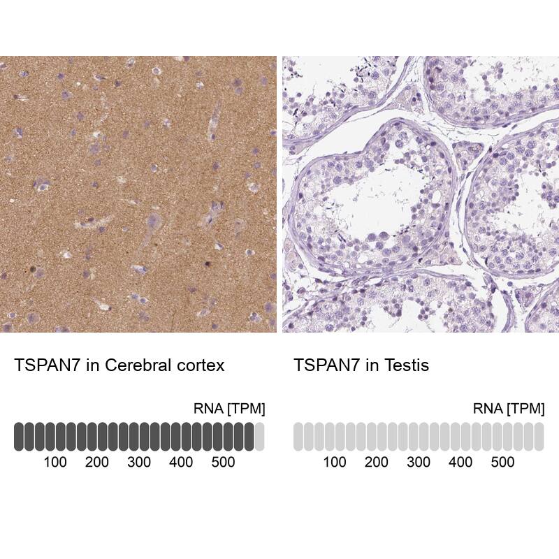 Analysis in human cerebral cortex and testis tissues using NBP3-44062 antibody. Corresponding TSPAN7/TM4SF2 RNA-seq data are presented for the same tissues.