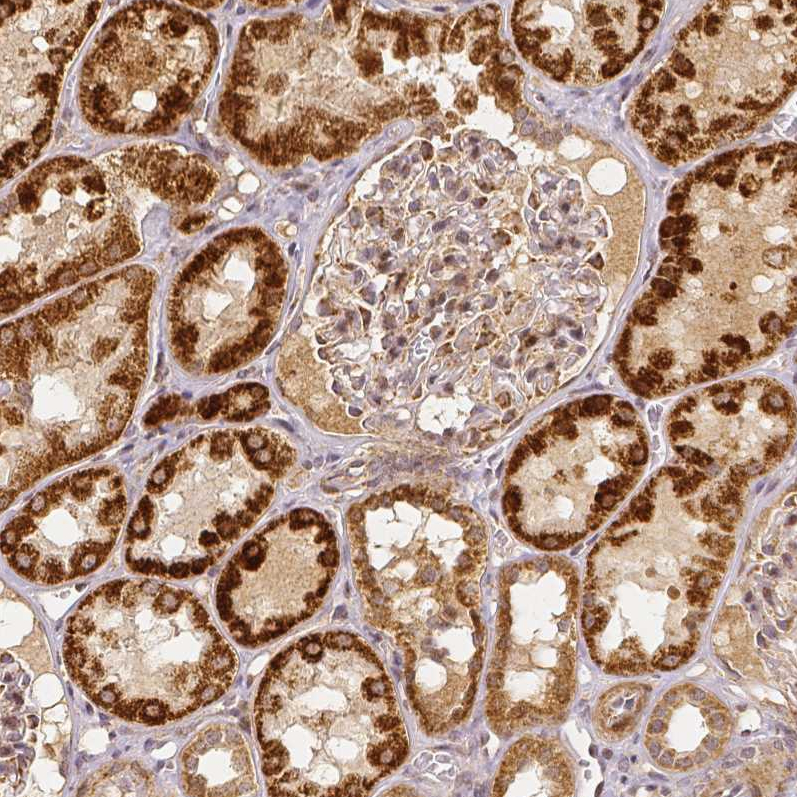 Staining of human kidney shows moderate to strong cytoplasmic positivity in cells in tubules.
