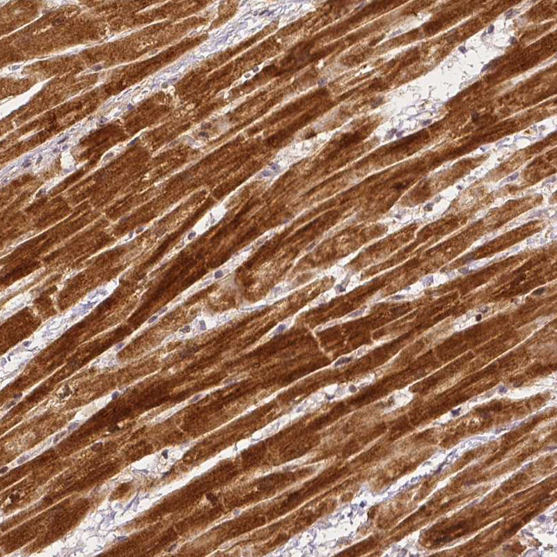 Staining of human heart muscle shows strong cytoplasmic positivity in cardiomyocytes.