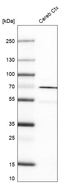 Analysis in human cerebral cortex tissue.