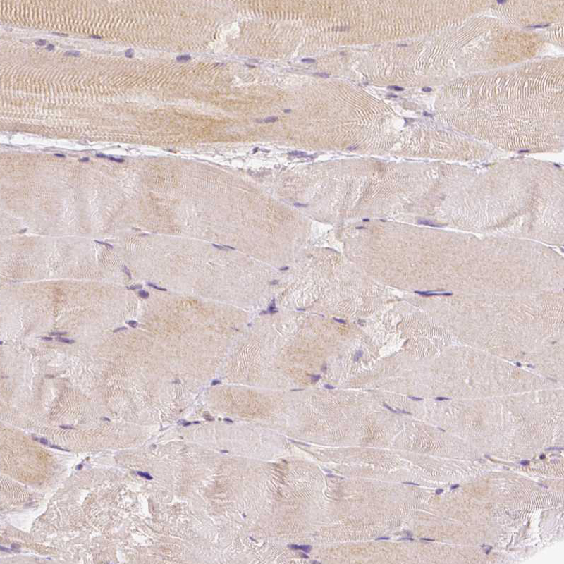 Staining of human skeletal muscle shows only very weak cytoplasmic positivity in striated muscle fibers.