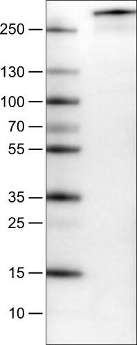 Lane 1: Marker [kDa]Lane 2: Human cell line U-251