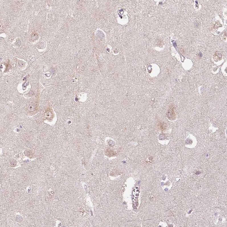 Staining of human cerebral cortex shows weak cytoplasmic positivity in neurons.
