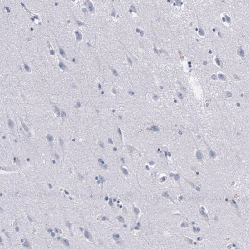 <b>Orthogonal Strategies Validation. </b>Staining of human cerebral cortex shows no positivity in neurons as expected.