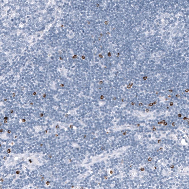 Staining of human lymph node shows strong cytoplasmic positivity in a subset of non-germinal center cells.