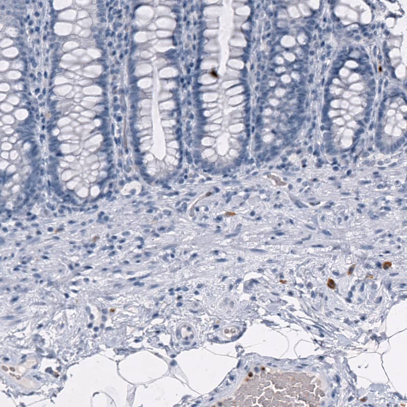 Staining of human rectum shows strong cytoplasmic positivity in a subset of lymphoid cells.