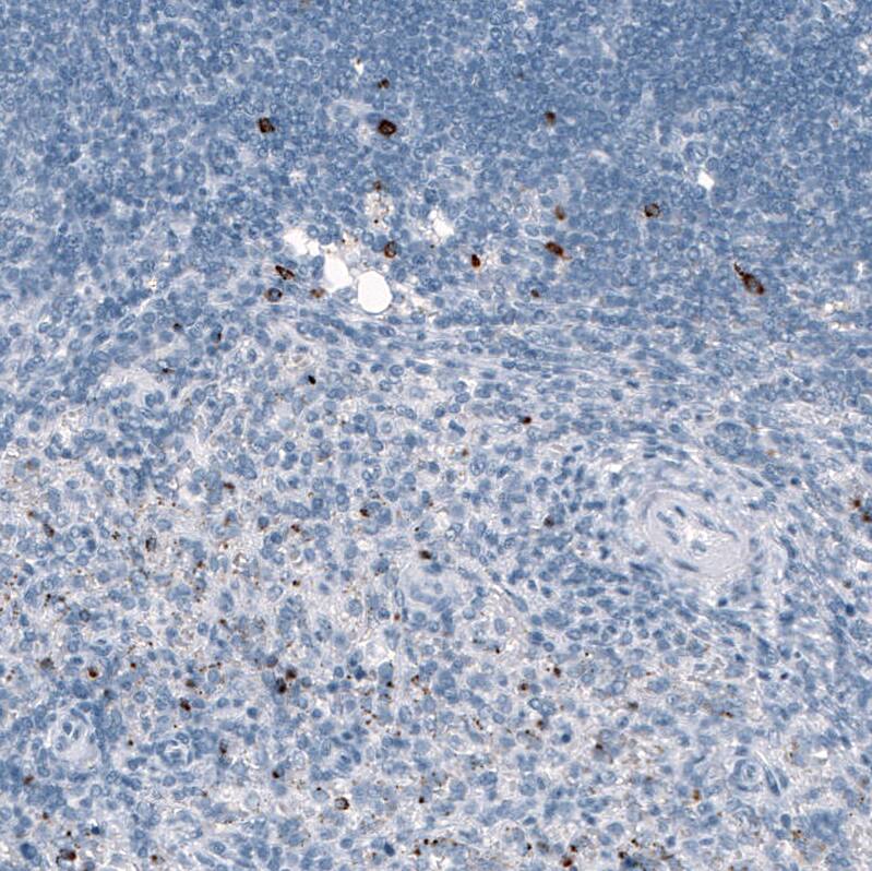 Staining of human spleen shows strong cytoplasmic positivity in a subset of cells in red pulp.
