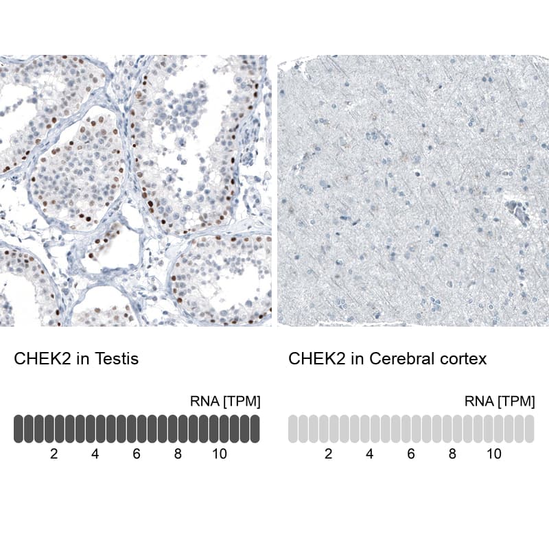 Analysis in human testis and cerebral cortex tissues using NBP3-44069 antibody. Corresponding Chk2 RNA-seq data are presented for the same tissues.