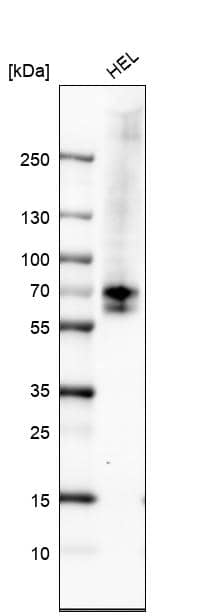 Analysis in human cell line HEL.