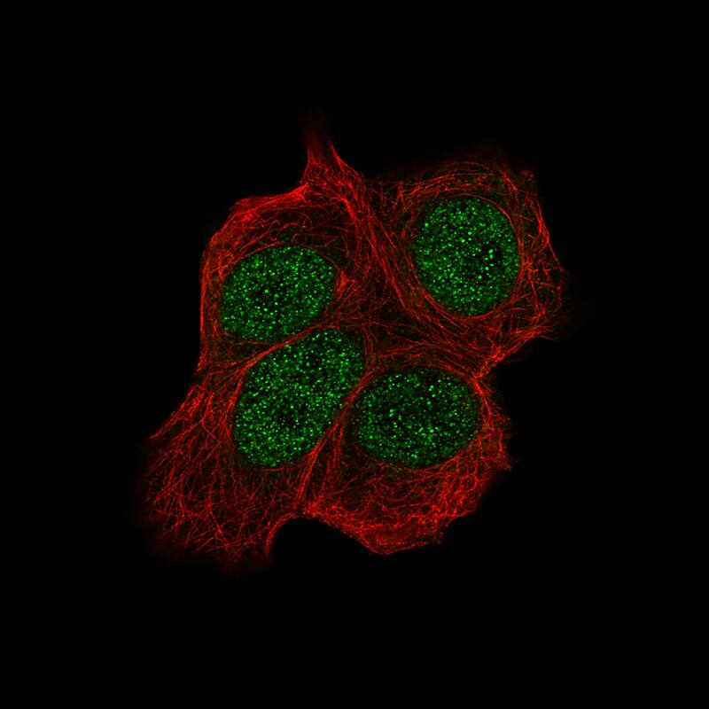 Staining of MCF7 cells using the Anti-Chk2 monoclonal antibody) . 