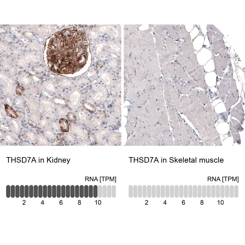Analysis in human kidney and skeletal muscle tissues using NBP3-44071 antibody. Corresponding THSD7A RNA-seq data are presented for the same tissues.