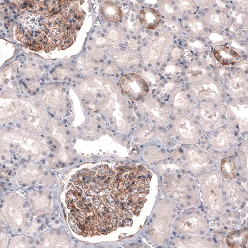 Staining of human kidney shows moderate membranous positivity in cells in glomeruli, as well as in a subset of renal tubules.