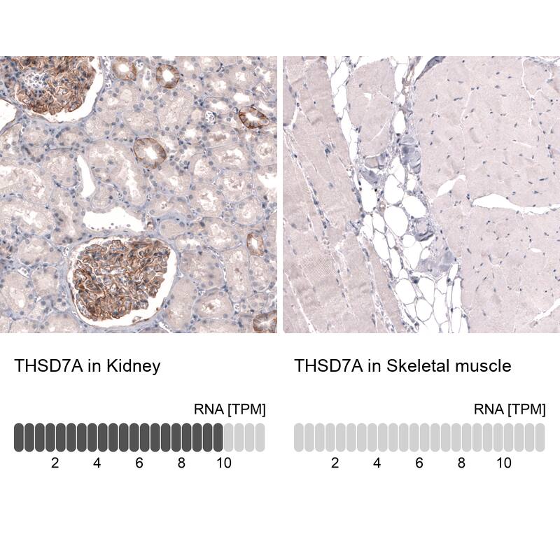 Analysis in human kidney and skeletal muscle tissues using NBP3-44072 antibody. Corresponding THSD7A RNA-seq data are presented for the same tissues.
