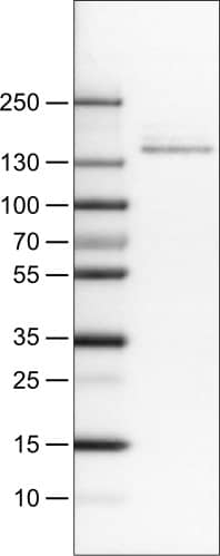 Lane 1: Marker [kDa]Lane 2: Human cell line RT-4