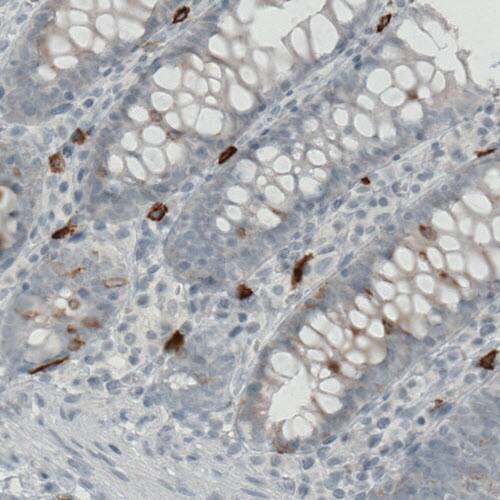 Staining of human colon shows strong immunoreactivity in some lymphoid cells.