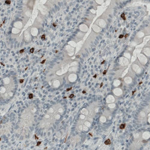 Staining of human small intestine shows strong immunoreactivity in a subset of lymphoid cells.