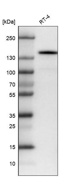 Analysis in human cell line RT-4.