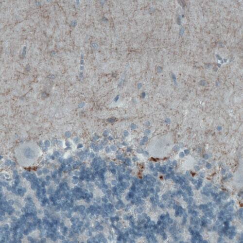 Staining of human cerebellum shows moderate positivity in neuropil of the molecular layer.