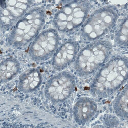 Staining of human colon shows strong immunoreactivity in a subset of lymphoid cells.