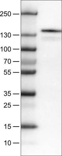 Lane 1: Marker [kDa]Lane 2: Human cell line RT-4