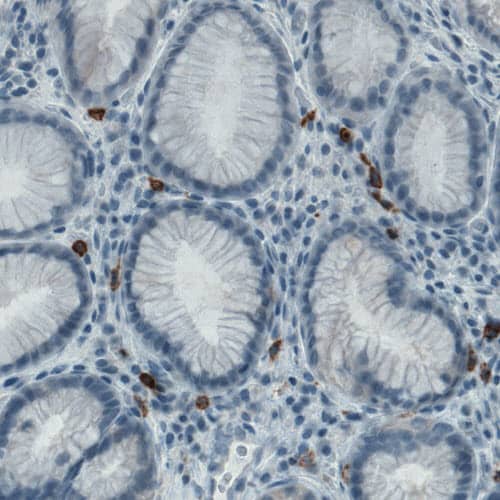 Staining of human stomach shows strong positivity in a subset of lymphoid cells.